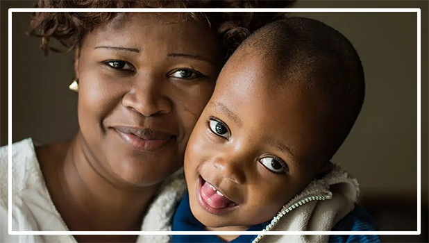 Hidrocefalia | Asesbih Perú